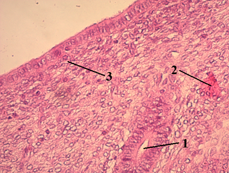 endometrit-maksinon-image7.png